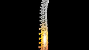 Oracle Pain Clinic Spinal Cord Stimulation